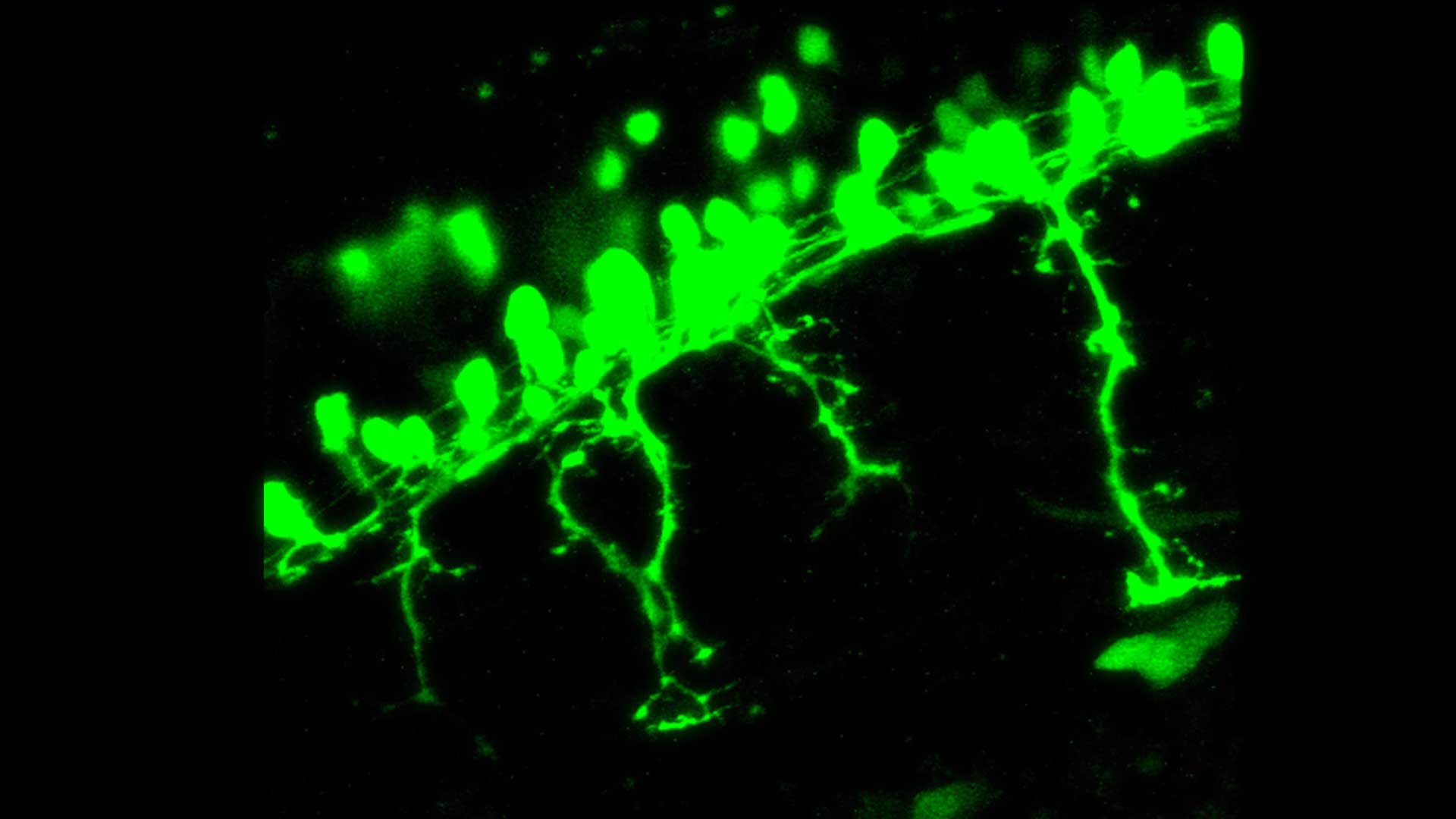 TRANSCRIPTIONAL ENHANCEMENT OF SMN LEVELS IN MOTONEURONS IS CRUCIAL FOR PROPER AXON MORPHOLOGY IN ZEBRAFISH