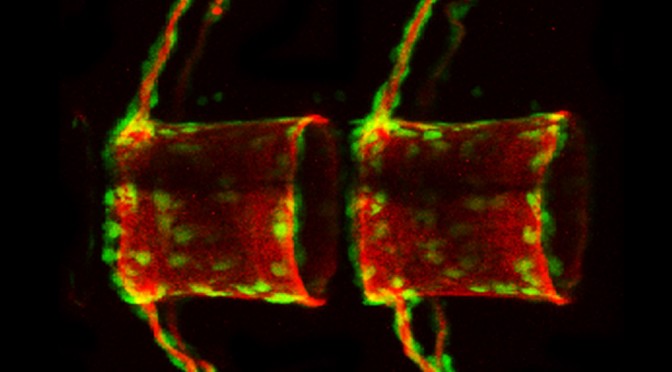 A COL10A1: NLGFP TRANSGENIC LINE DISPLAYS PUTATIVE OSTEOBLAST PRECURSORS AT THE MEDAKA NOTOCHORDAL SHEATH PRIOR TO MINERALIZATION